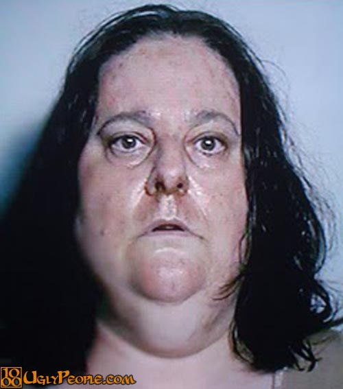 Fat Ugly Woman Picture 62