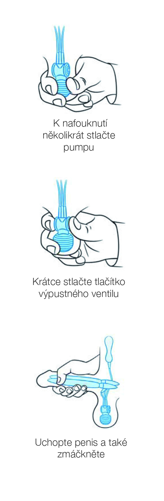 Penilní implantát.