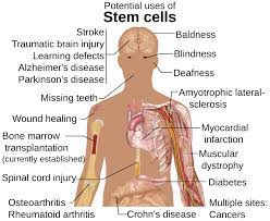 S čím mohou kmen. buňky pomoci: Infarkt, mrtvice, hluchota, slepota, Alzheimer