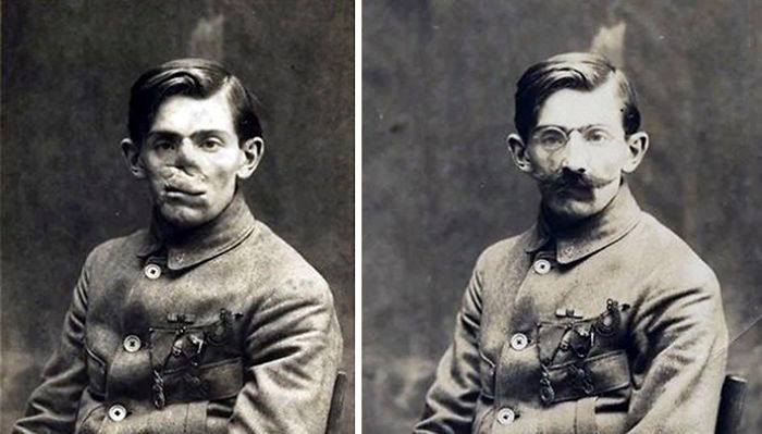 Další z veteránů první světové války bez masky a s maskou.