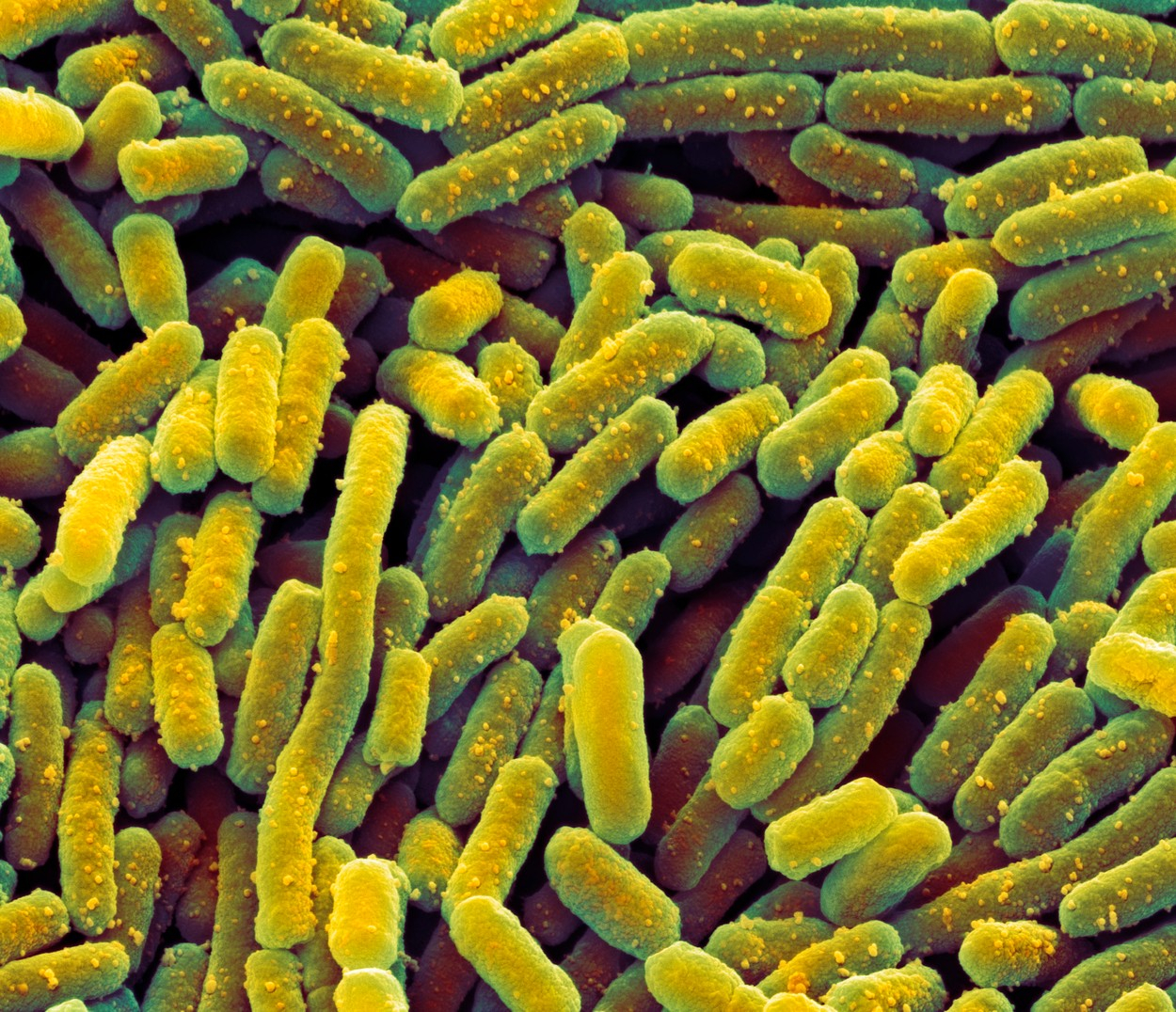 Lactobacillus