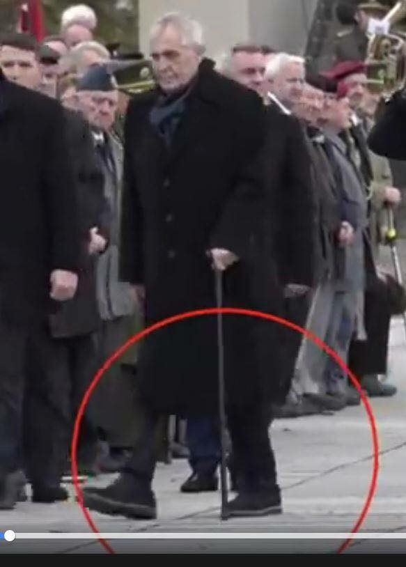 Spekulace o amputované noze Miloše Zemana kolují světem internetu několik dní.