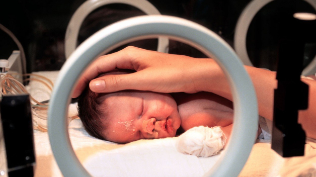 V roce 2012 se v celé ČR narodilo takto postižených dětí 48 na 1000 živě narozených dětí.