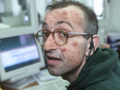 Tento člověk má intelektuální akné