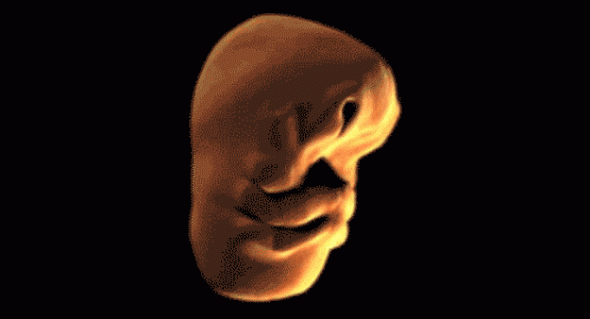 8 Jak se vyvíjí lidská tvář v děloze? 