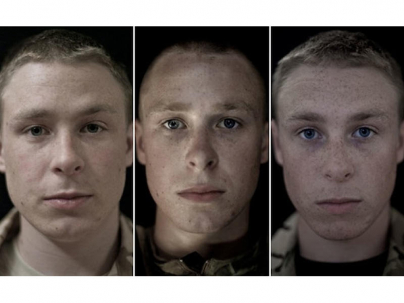 Nejčastěji bývalí vojáci trpí posttraumatickou stresovou poruchou a traumatickým poškozením mozku